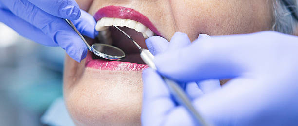 Best Emergency Wisdom Teeth Removal in Neshanic Station, NJ